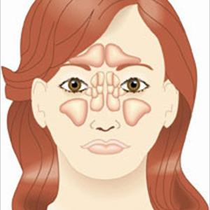 Untreated Sinus Infection 
