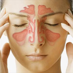 Remedy For Blocked Sinus 