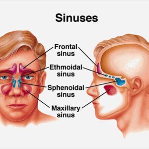 Natural Ways To Shrink Swollen Nasal Passages 