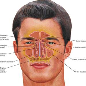Best Way To Treat A Sinus Infection - Symptoms That You Have A Clogged Sinus
